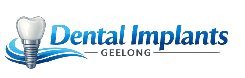 dentalimplantsgeelongau.com